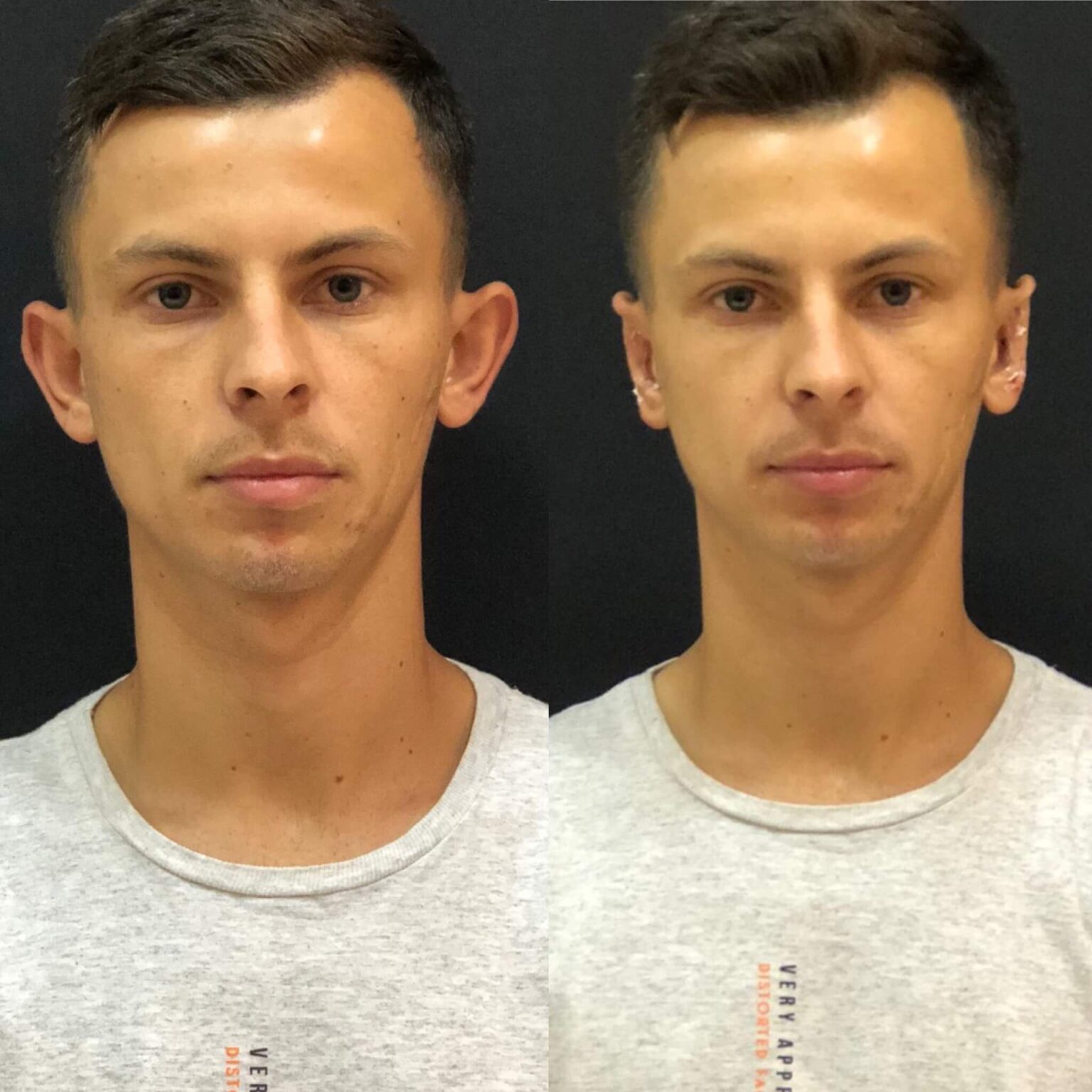 9CE526E6-CCB5-4DE0-90A1-AAA324BE3C73