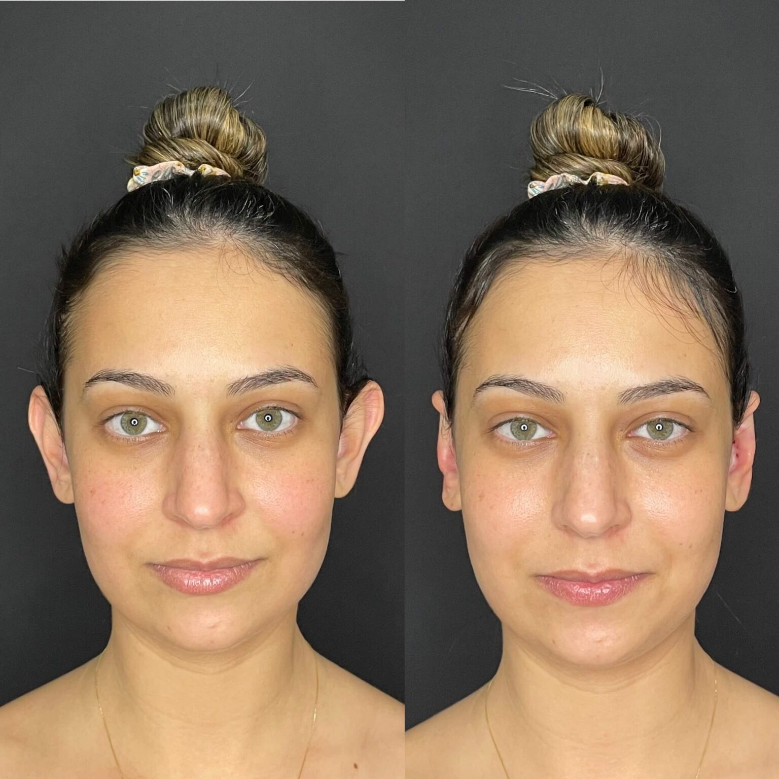 B0E40777-9605-4648-8CE7-C74C2217FF29