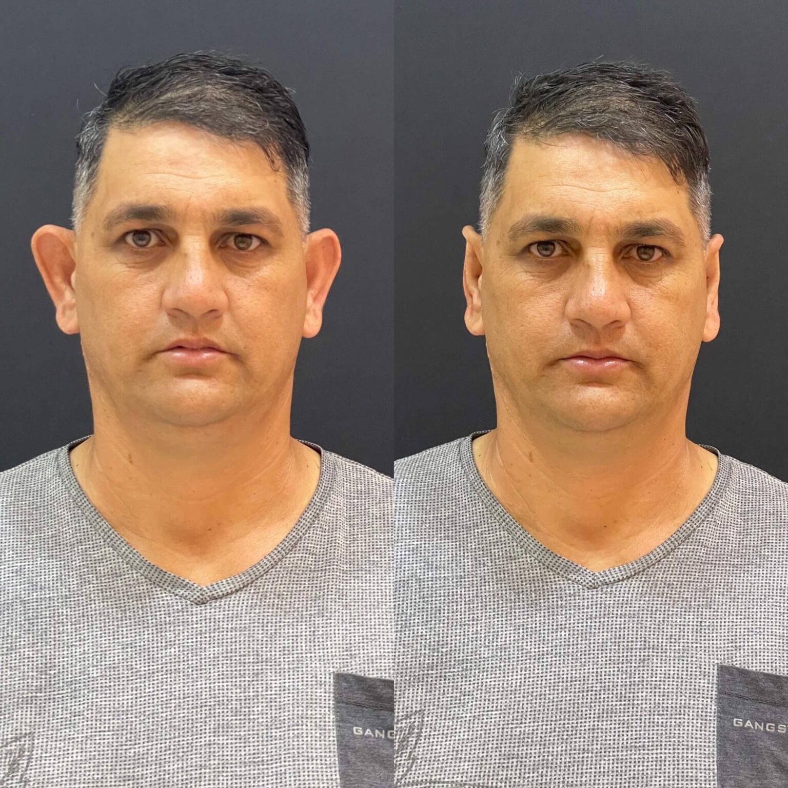 E7F656AE-2180-4197-A04B-E4653FAB526E